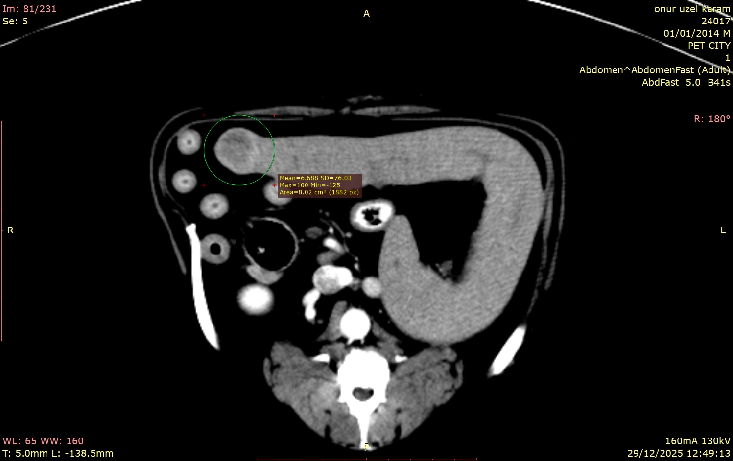 kopek-karin-bilgisayarli-tomografi-goruntusu-dalak-ve-prostat